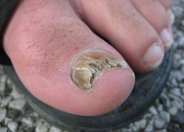 Rezultatul neglijării