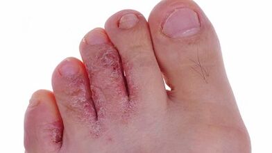 Tipuri și etape ale dezvoltării ciupercii pe picioare