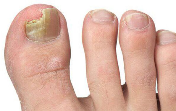 Diverse forme de ciuperci