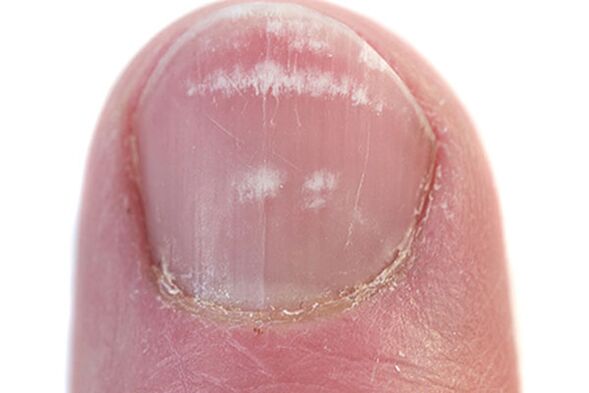 Primele semne și simptome