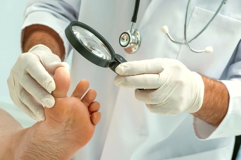 dermatolog care examinează unghiile de la picioare