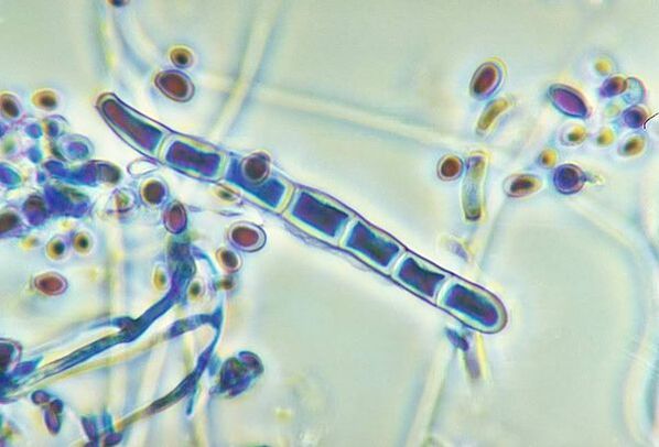 Ciuperca Trichophyton rubrum la microscop